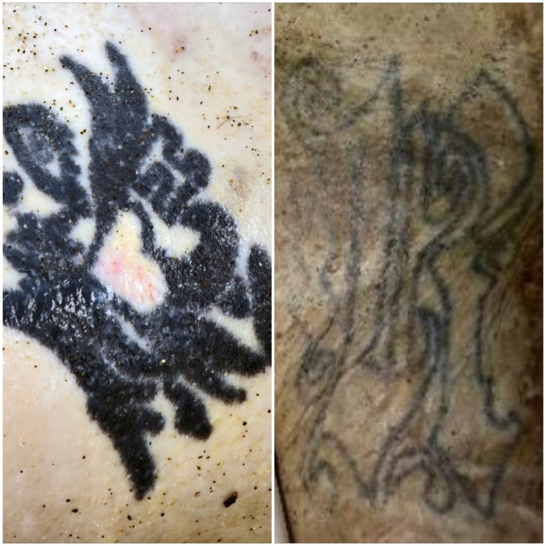 foto tatuaggi cadavere